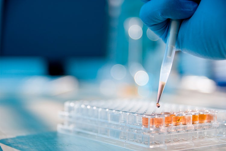 hand holding pipette drips liquid into sample tray